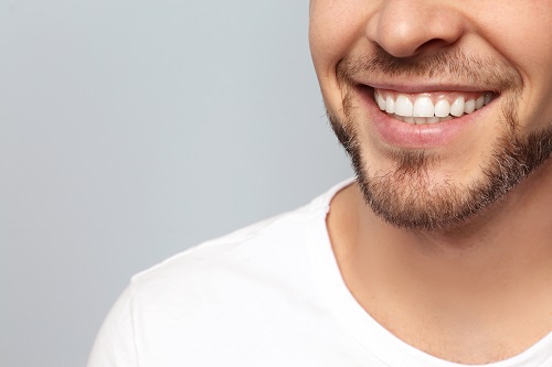 Quem tem lentes de contatos dentais pode usar Invisalign? – Dra